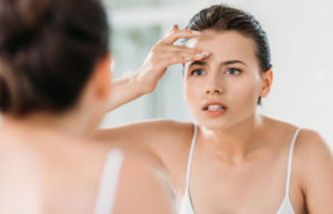How to Get Rid of Blackheads on Forehead